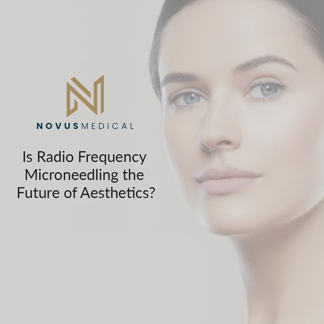 Is Radio Frequency Microneedling the Future of Aesthetics?