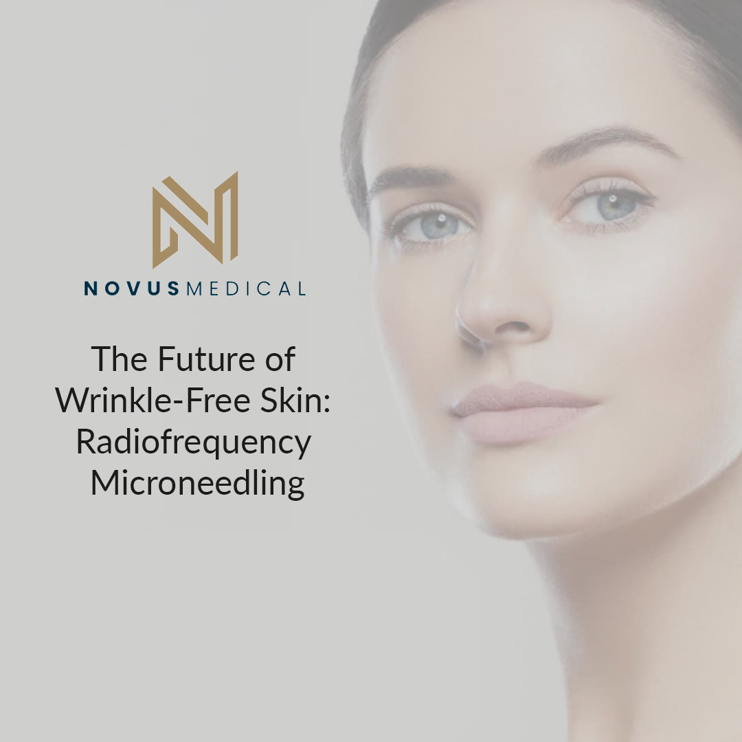The Future of Wrinkle-Free Skin: Radiofrequency Microneedling