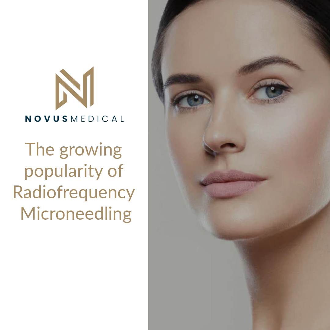 The growing popularity of Radiofrequency Microneedling